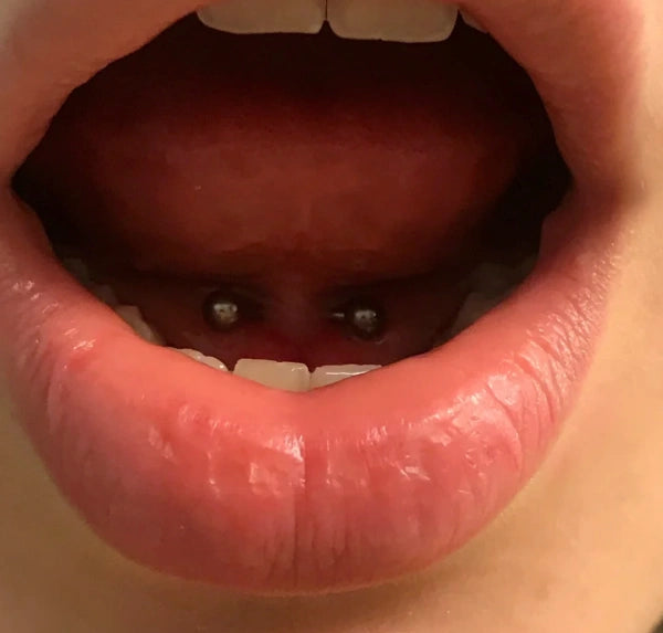 Tongue piercing in mouth
